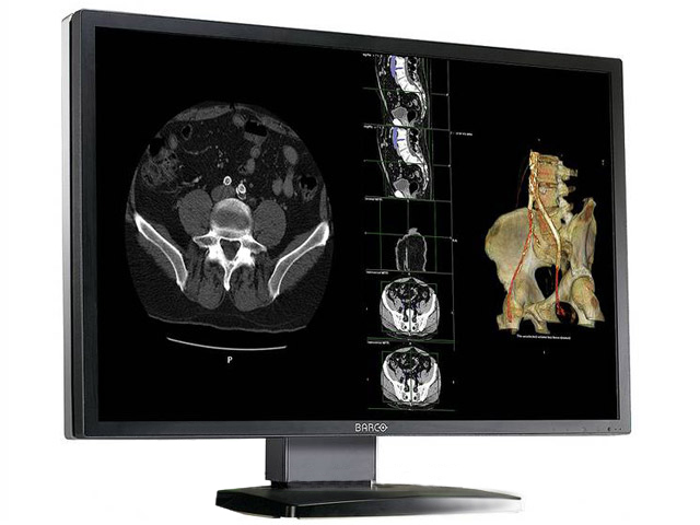 Barco Nio Fusion 4MP 30" Color DuoView Medical Display MDNC 4130 - Click Image to Close